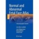 Normal and Abnormal Fetal Face Atlas: Ultrasonographic Features