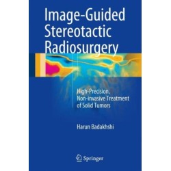Image-Guided Stereotactic Radiosurgery: High-Precision, Non-invasive Treatment of Solid Tumors