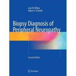 Biopsy Diagnosis of Peripheral Neuropathy