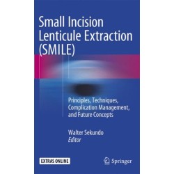 Small Incision Lenticule Extraction (SMILE): Principles, Techniques, Complication Management, and Future Concepts
