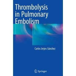 Thrombolysis in Pulmonary Embolism