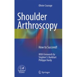 Shoulder Arthroscopy: How to Succeed!