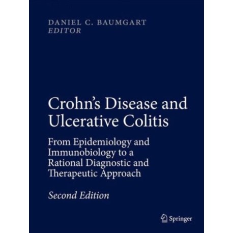 Crohn's Disease and Ulcerative Colitis: From Epidemiology and Immunobiology to a Rational Diagnostic and Therapeutic Approach