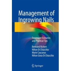 Management of Ingrowing Nails: Treatment Scenarios and Practical Tips