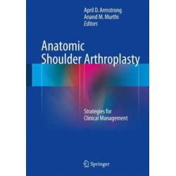 Anatomic Shoulder Arthroplasty: Strategies for Clinical Management