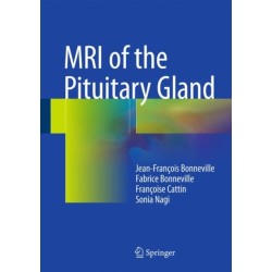 MRI of the Pituitary Gland