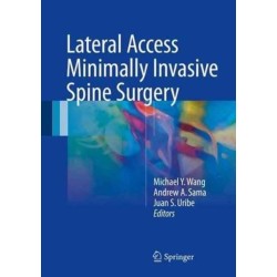 Lateral Access Minimally Invasive Spine Surgery