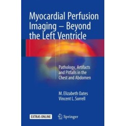 Myocardial Perfusion Imaging - Beyond the Left Ventricle: Pathology, Artifacts and Pitfalls in the Chest and Abdomen