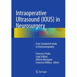 Intraoperative Ultrasound (IOUS) in Neurosurgery: From Standard B-mode to Elastosonography