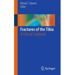 Fractures of the Tibia: A Clinical Casebook