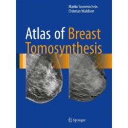 Atlas of Breast Tomosynthesis: Imaging Findings and Image-Guided Interventions