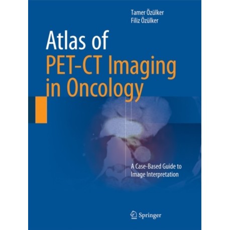 Atlas of PET-CT Imaging in Oncology: A Case-Based Guide to Image Interpretation