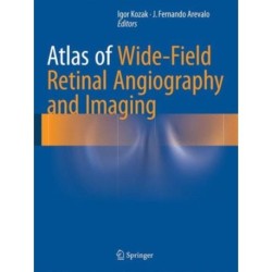 Atlas of Wide-Field Retinal Angiography and Imaging