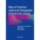 Atlas of Contrast-enhanced Sonography of Focal Liver Lesions