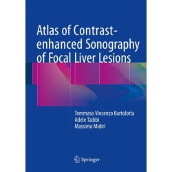 Atlas of Contrast-enhanced Sonography of Focal Liver Lesions