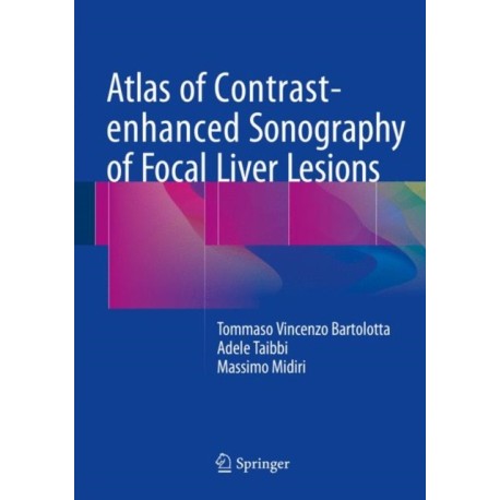 Atlas of Contrast-enhanced Sonography of Focal Liver Lesions