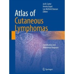 Atlas of Cutaneous Lymphomas: Classification and Differential Diagnosis