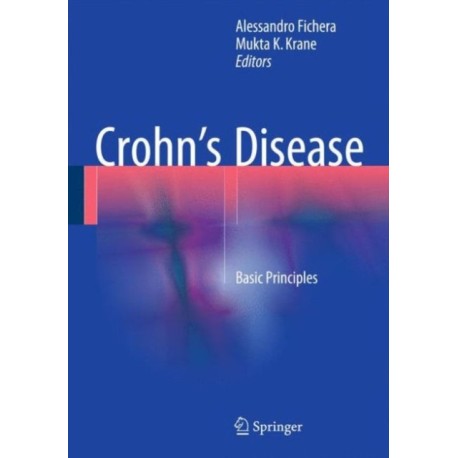 Crohn’s Disease: Basic Principles