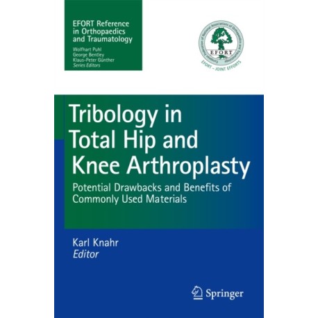 Tribology in Total Hip and Knee Arthroplasty: Potential Drawbacks and Benefits of Commonly Used Materials