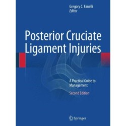 Posterior Cruciate Ligament Injuries: A Practical Guide to Management