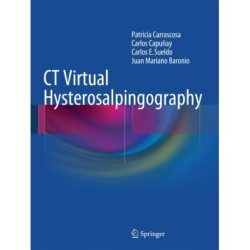 CT Virtual Hysterosalpingography