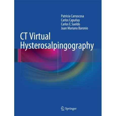 CT Virtual Hysterosalpingography