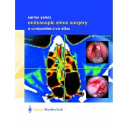 Endoscopic Sinus Surgery: A Comprehensive Atlas