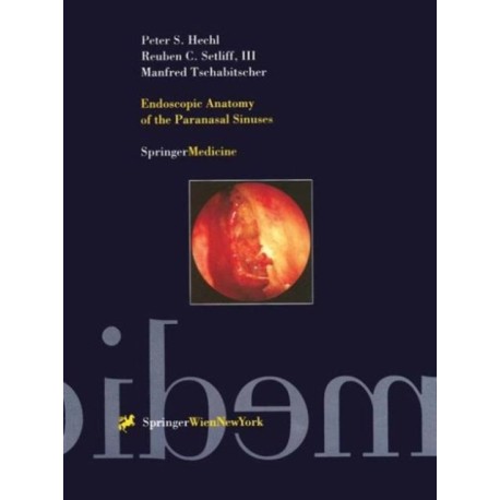 Endoscopic Anatomy of the Paranasal Sinuses