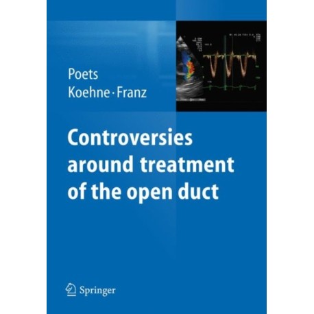 Controversies around treatment of the open duct
