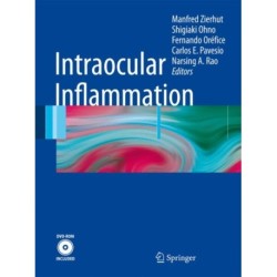 Intraocular Inflammation