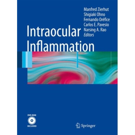 Intraocular Inflammation