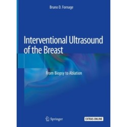 Interventional Ultrasound of the Breast: From Biopsy to Ablation