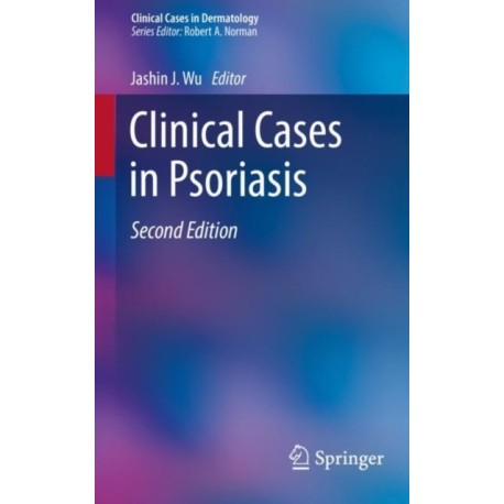 Clinical Cases in Psoriasis