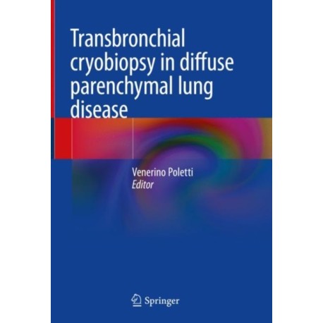 Transbronchial cryobiopsy in diffuse parenchymal lung disease