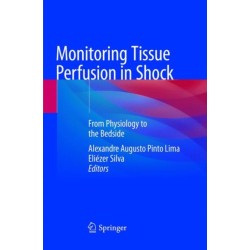 Monitoring Tissue Perfusion in Shock: From Physiology to the Bedside