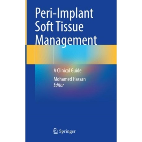 Peri-Implant Soft Tissue Management: A Clinical Guide
