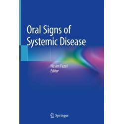 Oral Signs of Systemic Disease