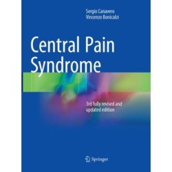 Central Pain Syndrome