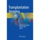 Transplantation Imaging