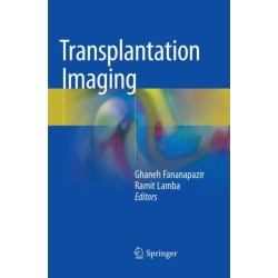 Transplantation Imaging