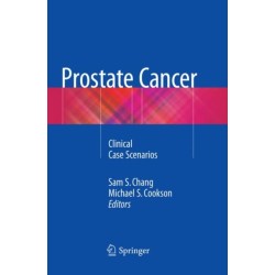 Prostate Cancer: Clinical Case Scenarios