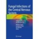 Fungal Infections of the Central Nervous System: Pathogens, Diagnosis, and Management