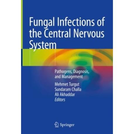 Fungal Infections of the Central Nervous System: Pathogens, Diagnosis, and Management