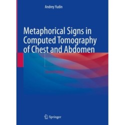 Metaphorical Signs in Computed Tomography of Chest and Abdomen