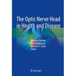 The Optic Nerve Head in Health and Disease