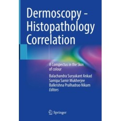 Dermoscopy - Histopathology Correlation: A Conspectus in the Skin of colour