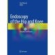 Endoscopy of the Hip and Knee: Principle and Practice