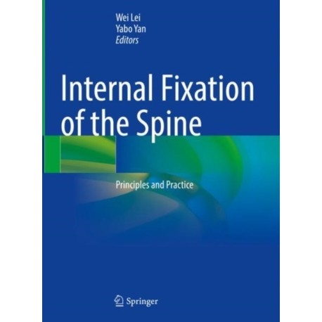 Internal Fixation of the Spine: Principles and Practice