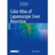 Color Atlas of Laparoscopic Liver Resection