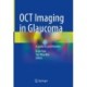 OCT Imaging in Glaucoma: A guide for practitioners